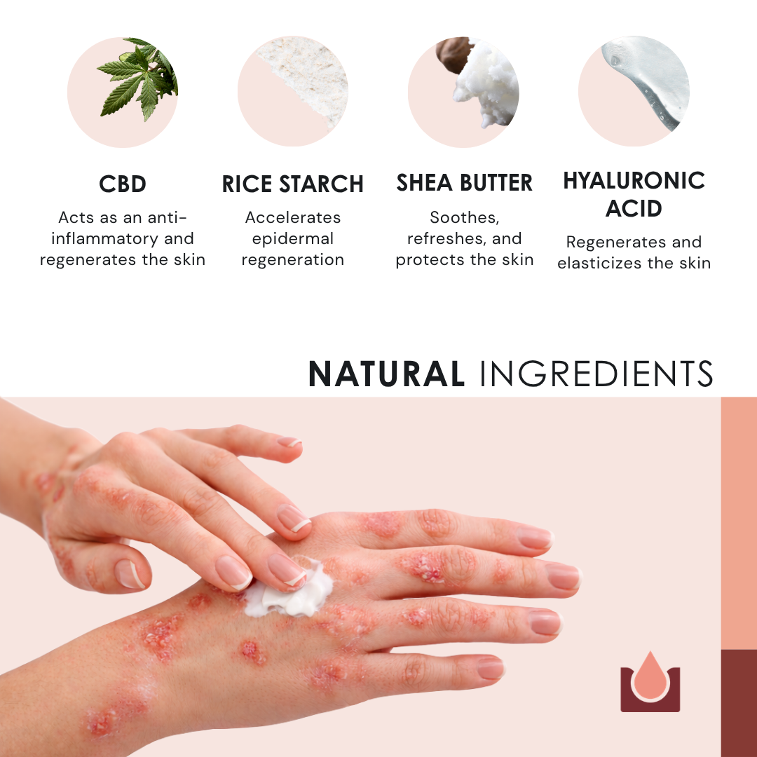Natural soothing cream for Psoriasis - 2x50ml