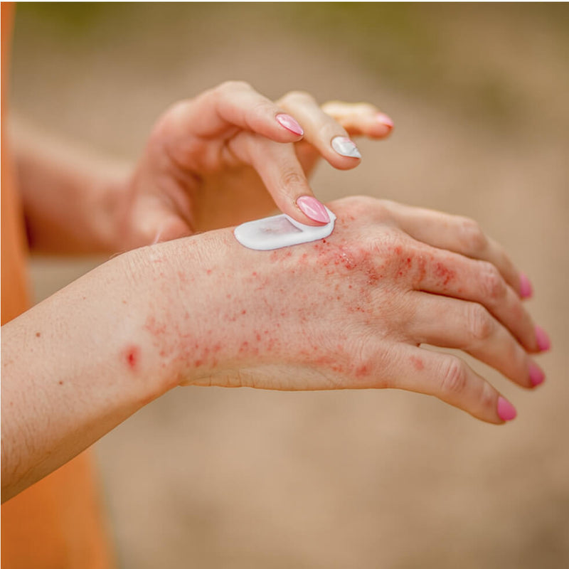 Hemp Cream Derma: CBD cream for sensitive and dry skin